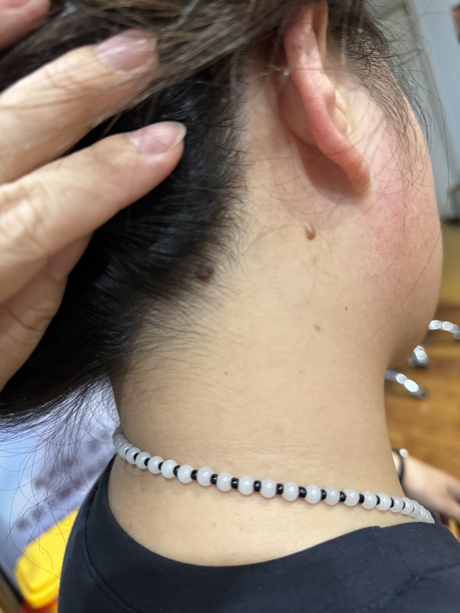 曲中周斑敏痘皮肤管理(全国招商中)