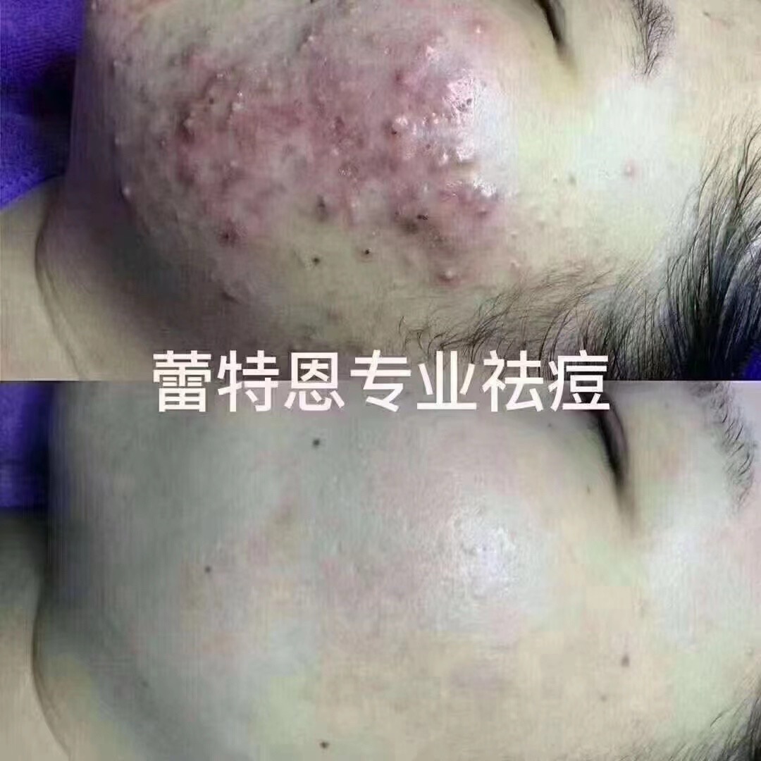 蕾特恩面部皮肤管理中心(通辽旗舰店)