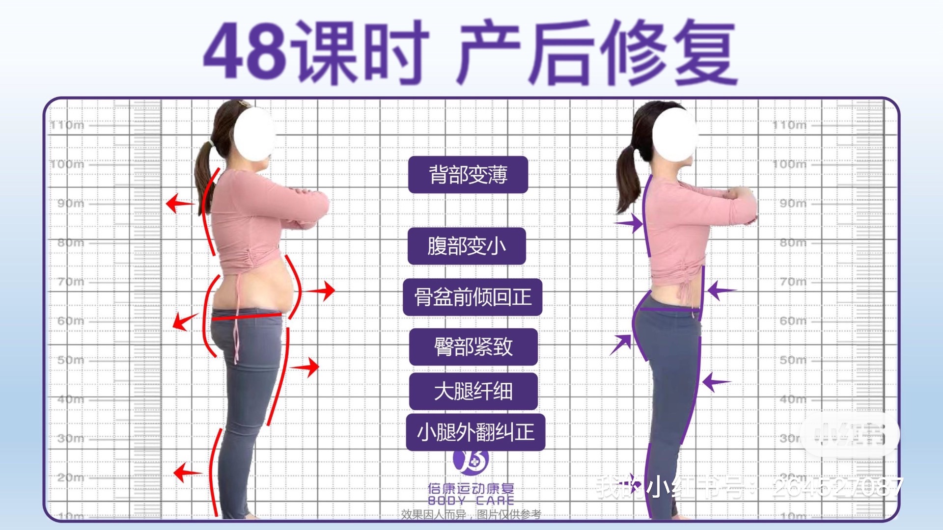 场地封面-倍康运动康复产后修复体态调整(卓越·世纪中心3号楼B座店)