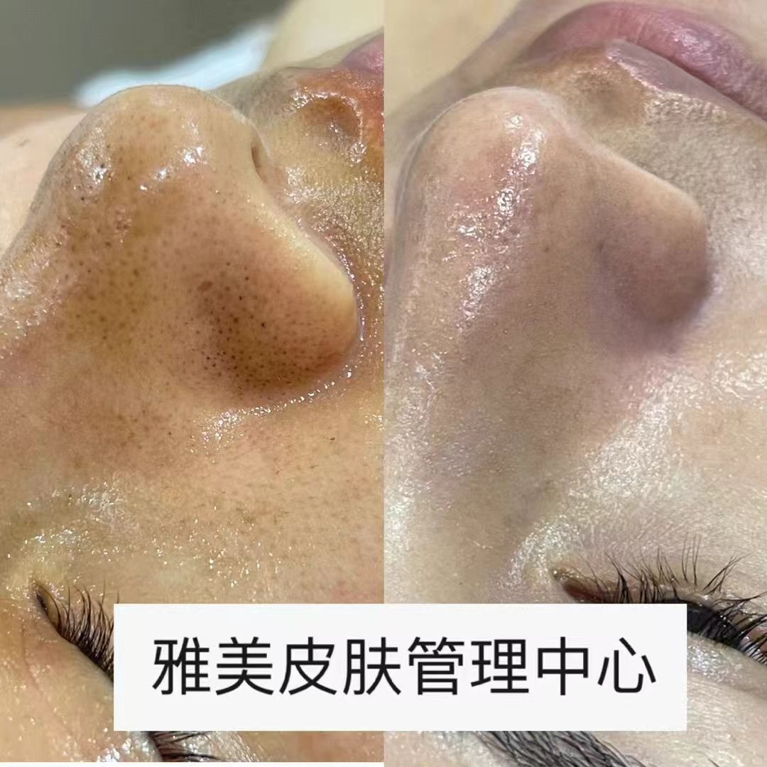 雅美皮肤管理中心